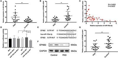 miR-193a-3p Mediates Placenta Accreta Spectrum Development by Targeting EFNB2 via Epithelial-Mesenchymal Transition Pathway Under Decidua Defect Conditions